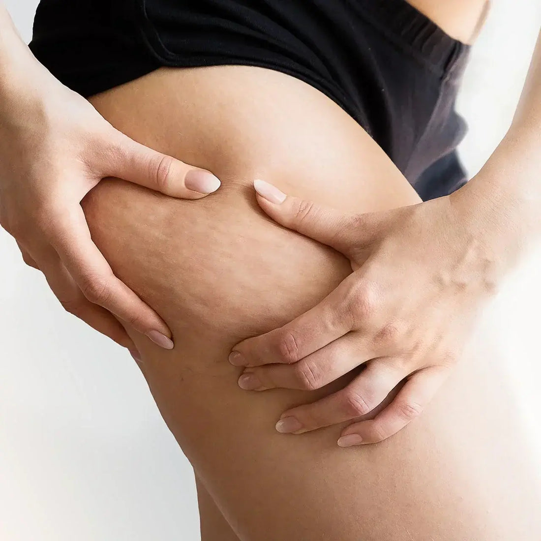 Mejora tu Circulación y Reduce la Celulitis: Guía Práctica para una Piel Más Firme