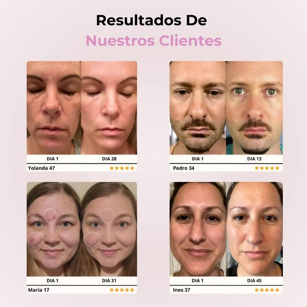 SkinGlow Pro™ Tratamiento Facial