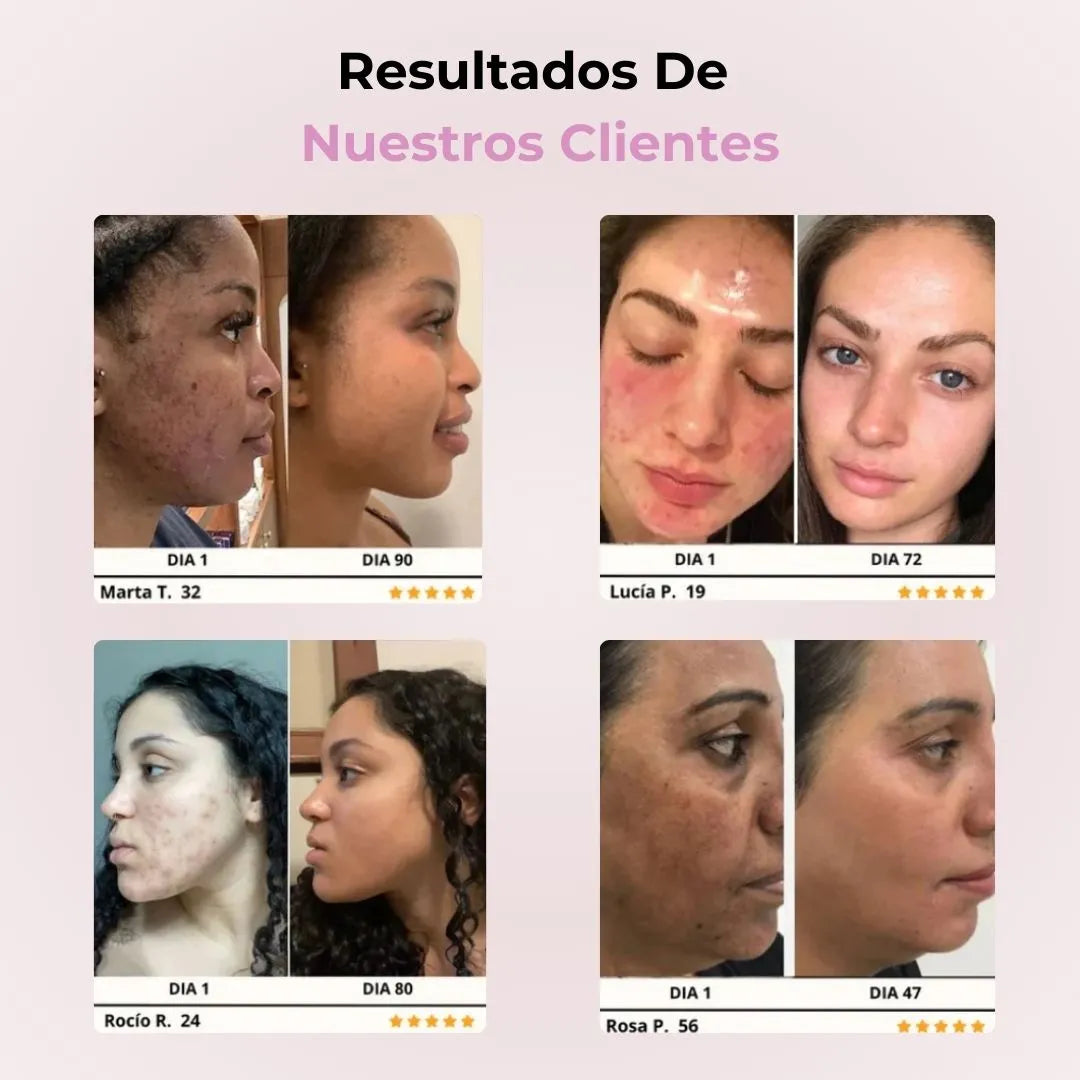 SkinGlow Pro™ Tratamiento Facial