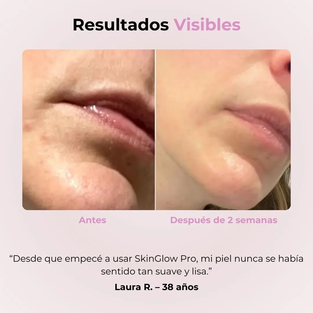 SkinGlow Pro™ Tratamiento Facial